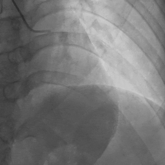 坐车时突然眼前一黑,是太累了还是心脏在「求救」?|一场「晕厥」的迷雾