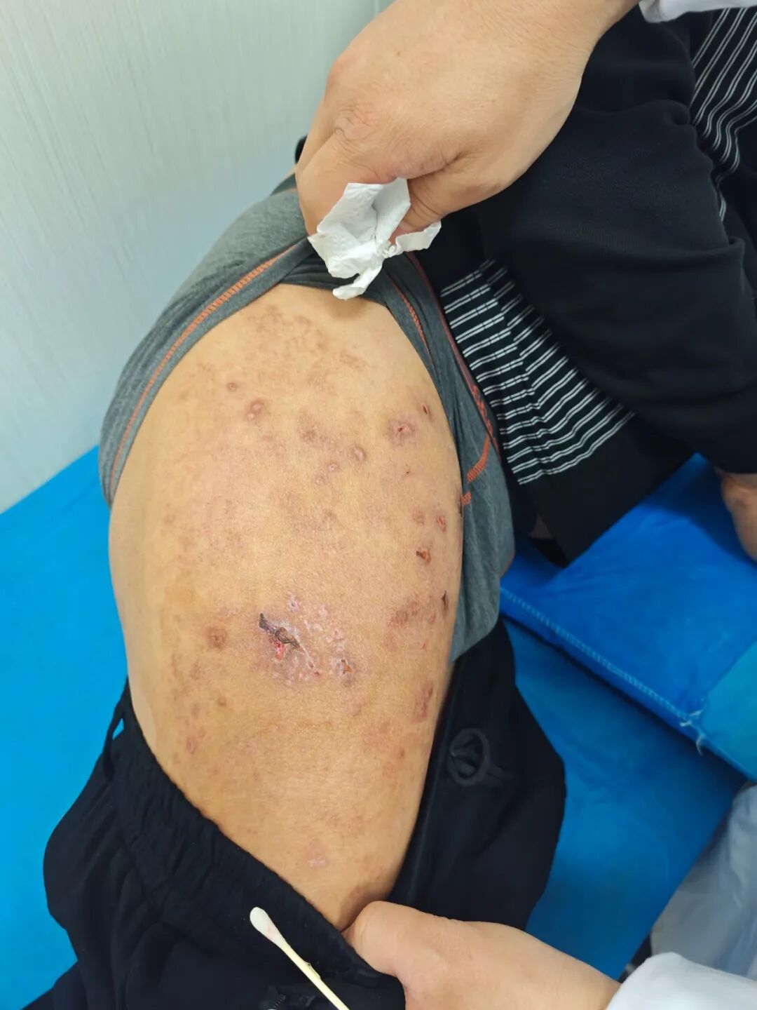 疼到睡不着、吃不下！顽固疼痛别硬扛！