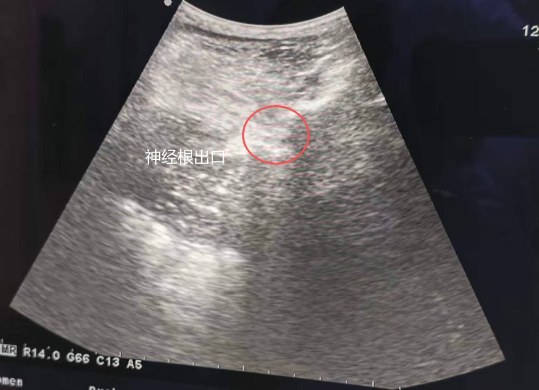 疼到睡不着、吃不下！顽固疼痛别硬扛！
