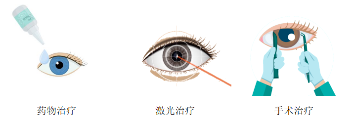 别让「视力的小偷」得逞！世界青光眼周，守护你的光明防线