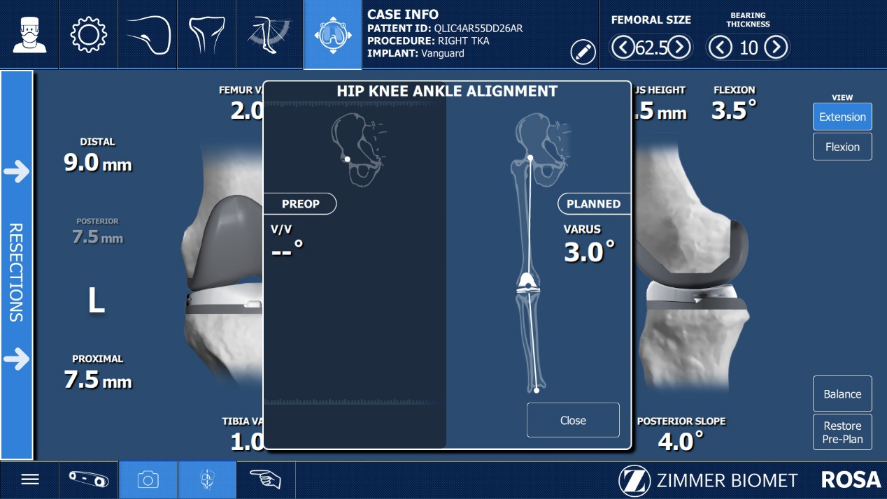 智慧骨科再添利器 成都京东方医院成功开展首例 ROSA 机器人辅助双膝关节置换术