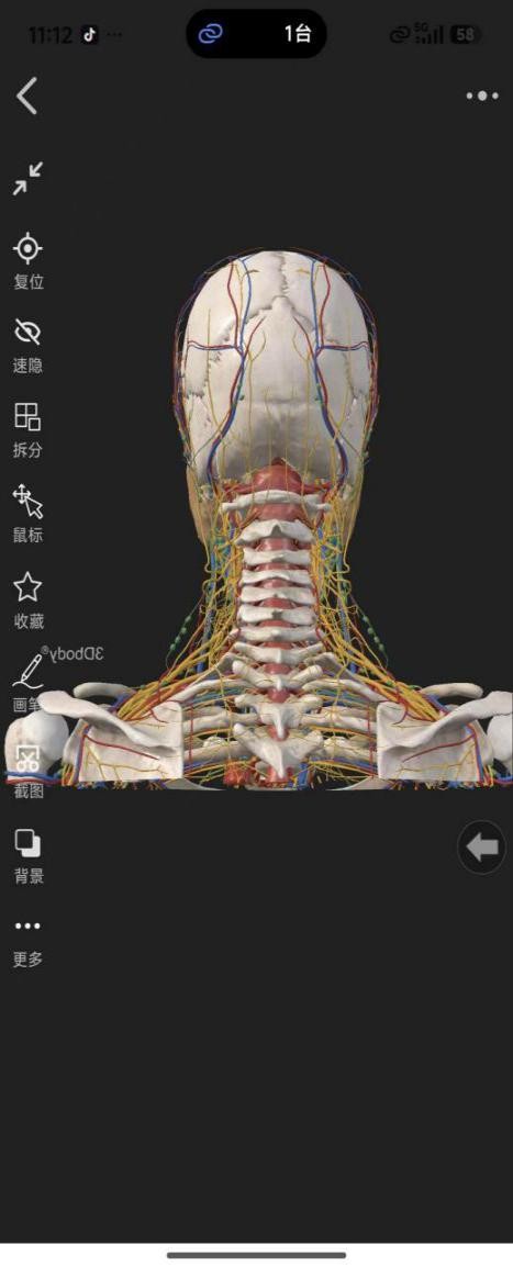 机器人精准 「拆弹」！郑州市中心医院脊柱外科攻克高龄复杂颈椎病手术难题