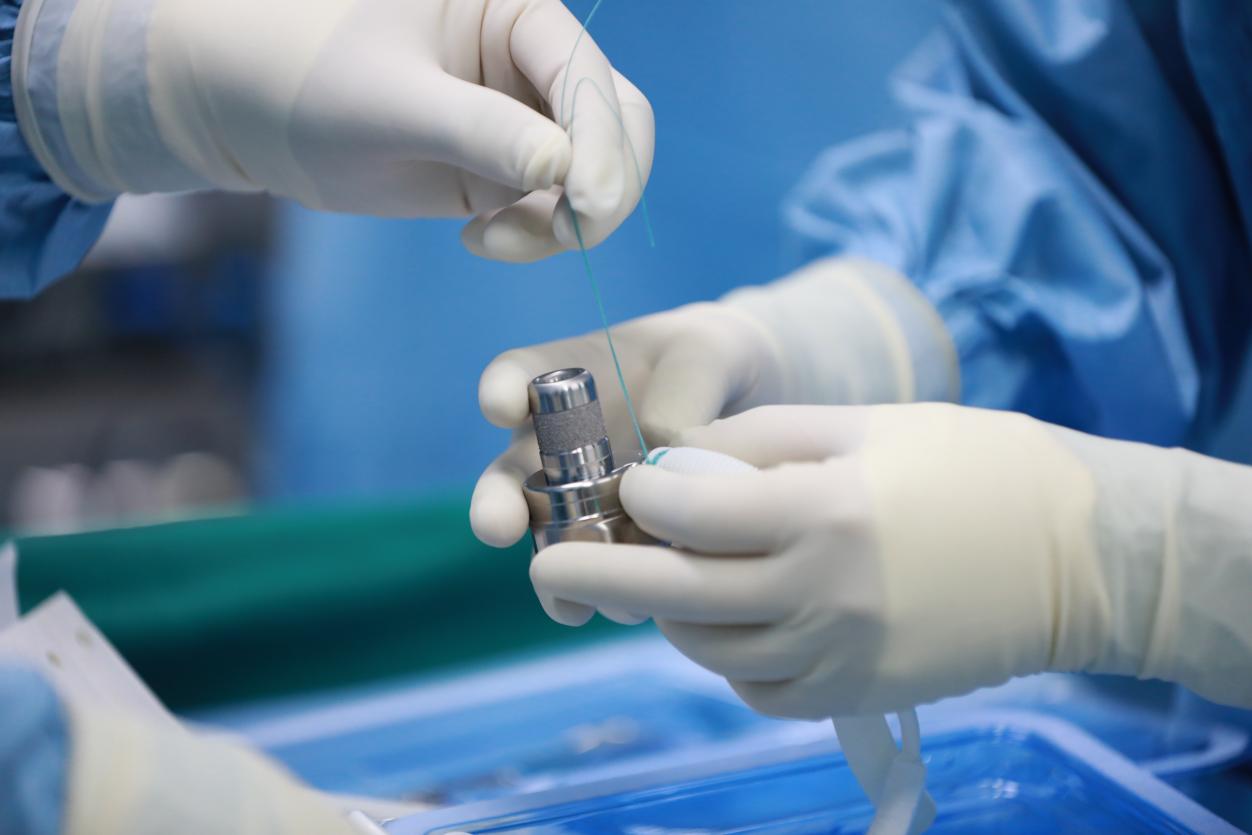 全程零输血!90 克「救命泵」植入心脏 13 岁扩心病男孩重获新生