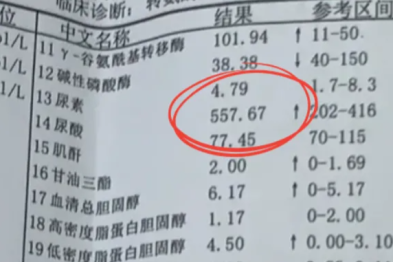 年纪轻轻关节痛，当心是痛风！这些习惯一定要注意！