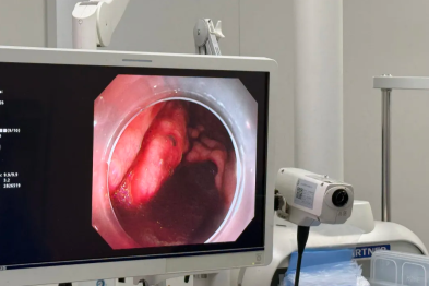 老人吐血一大盆，原因竟是几粒布洛芬