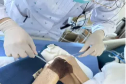 多重困境下的创面守护：燕达老年医学科 6 周专业护航，助力高龄患者创面恢复