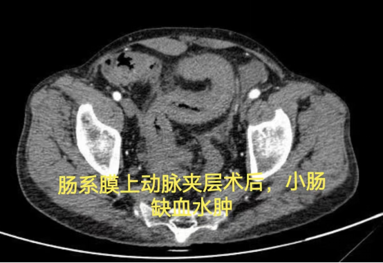 十大疑难病例，见证「硬核」守护