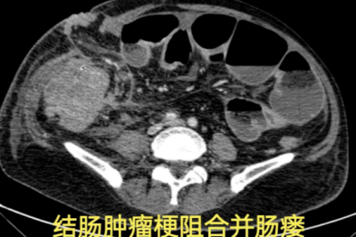 十大疑难病例，见证「硬核」守护