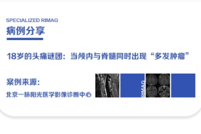 典型病例  |  18 岁的头痛谜团：当颅内与脊髓同时出现「多发肿瘤」