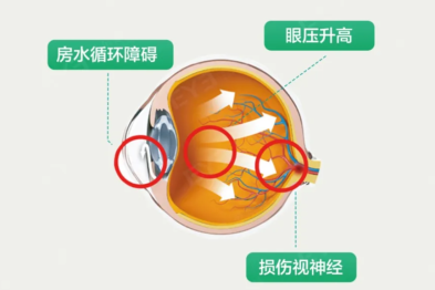 午休醒来看不清？很可能跟这个习惯有关（90% 办公族中招