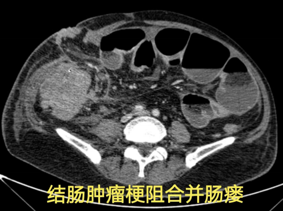 十大疑难病例，见证「硬核」守护