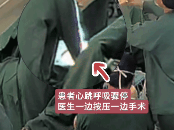 2 次心跳骤停！打开心包喷血 30 厘米，浙大四院心脏团队极限操作，抢回生命