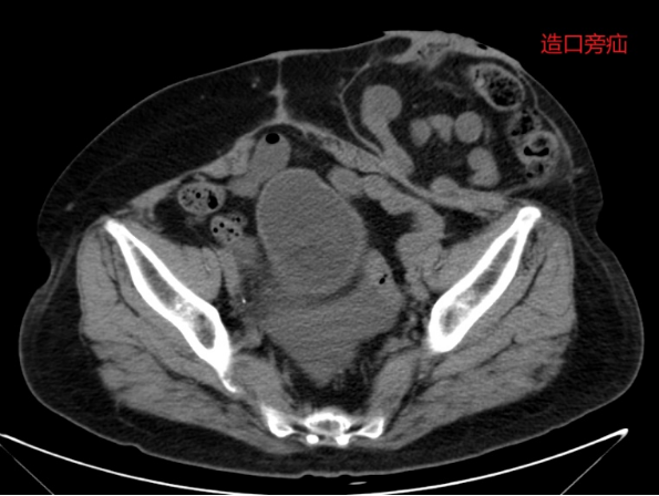 十大疑难病例，见证「硬核」守护