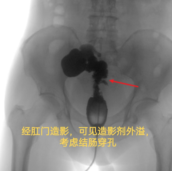 十大疑难病例，见证「硬核」守护