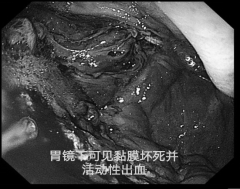 四次警报，四重挑战，四道生命之门！