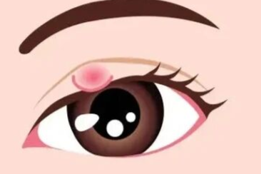 眼病高发季, 你需要这份春季护眼指南！