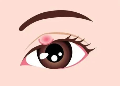 眼病高发季, 你需要这份春季护眼指南！