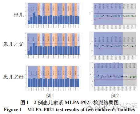 外显子 1 结构变异致脊髓性肌萎缩症 2 例临床分析并文献复习
