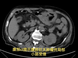 四次警报，四重挑战，四道生命之门！