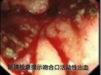 四次警报，四重挑战，四道生命之门！