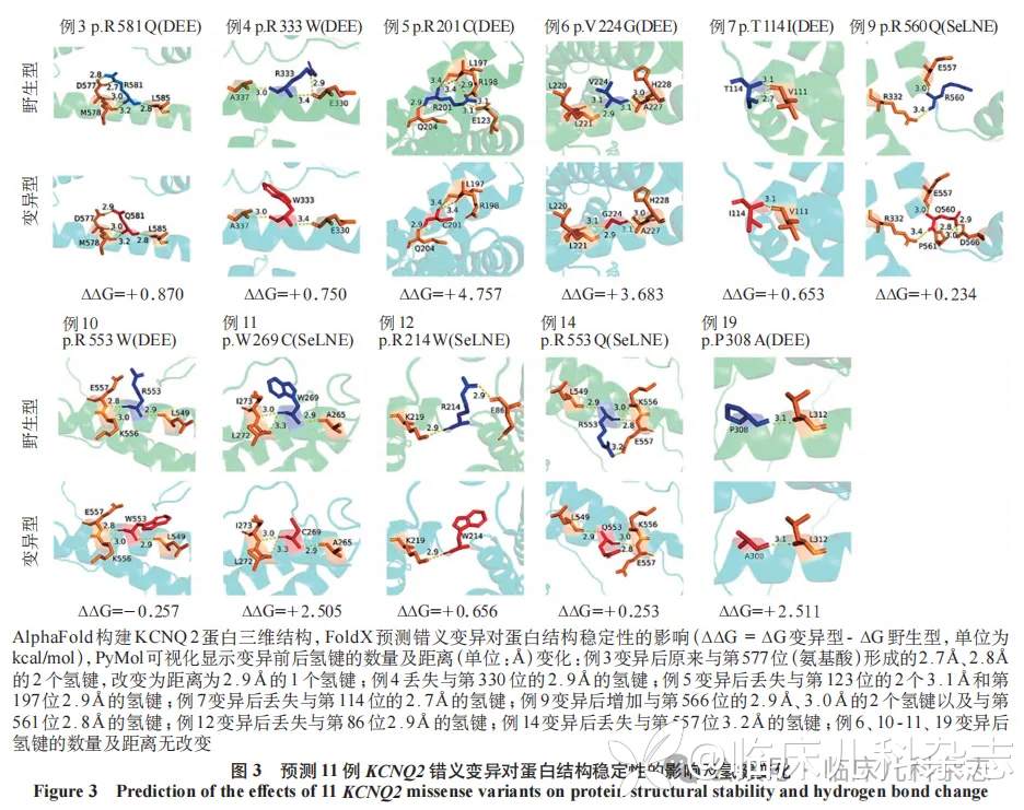 新生儿遗传性癫痫 43 例临床特征和基因型-表型关联分析