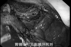 四次警报，四重挑战，四道生命之门！