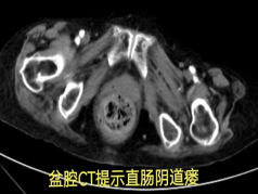 四次警报，四重挑战，四道生命之门！