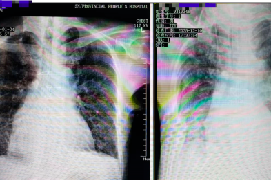 病例会说话 | 他曾是我的老师，后来我是他的医生