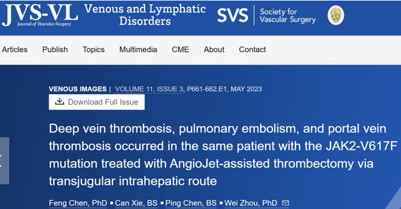 南大二附院介入科在门静脉血栓的病因及精准防治研究领域取得重大突破