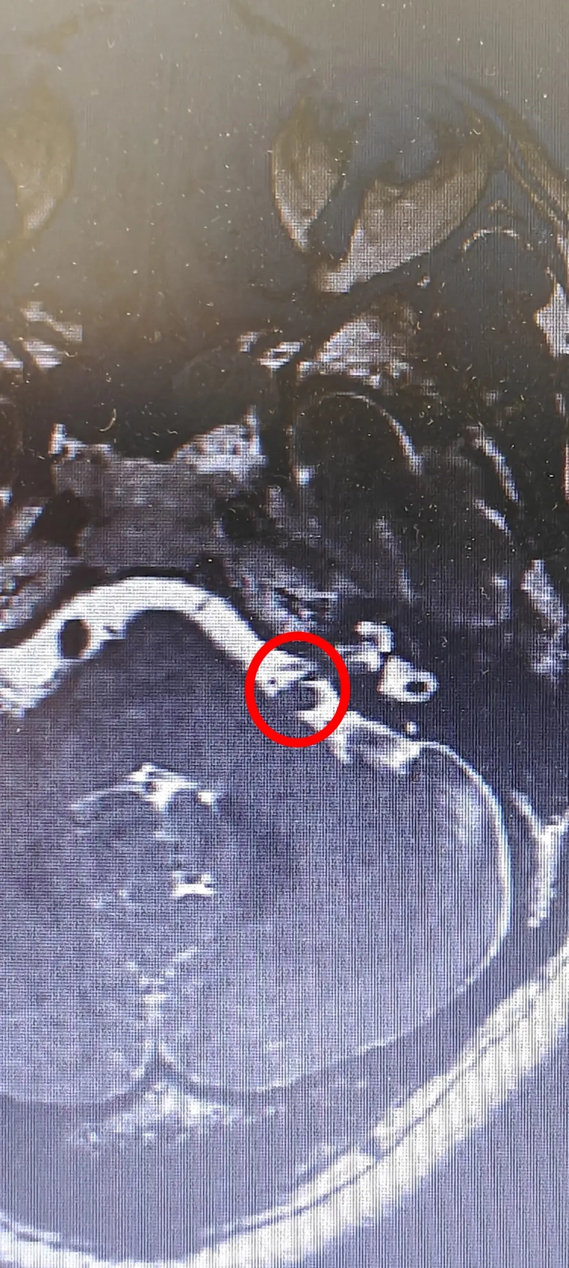 容易被忽视的听神经,竟然是耳鸣「真凶」