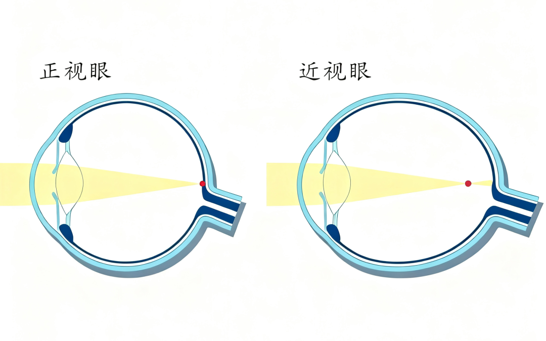 视觉训练，我劝你别乱做！