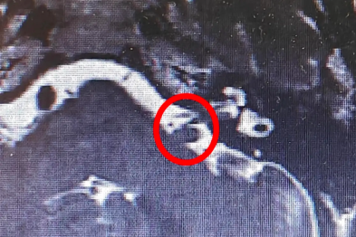 容易被忽视的听神经，竟然是耳鸣「真凶」