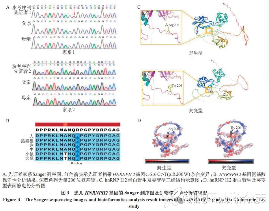 基于 X 染色体失活分析探讨 2 例 X 连锁智力障碍 Bain 型患儿的临床与遗传学特征