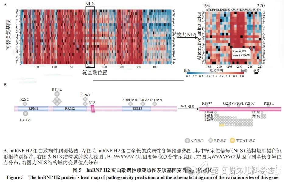 基于 X 染色体失活分析探讨 2 例 X 连锁智力障碍 Bain 型患儿的临床与遗传学特征