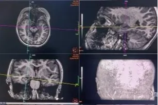 守护童年，远离「失神」迷雾