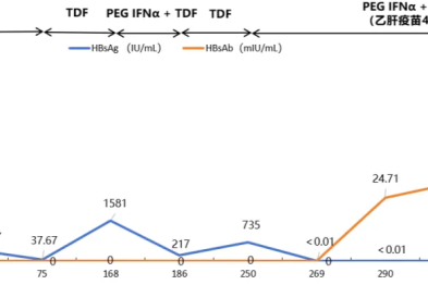 【愈见乙肝 2025】聚乙二醇干扰素α-2b 间歇治疗助力乙肝肝硬化患者实现 HBsAg 血清学转换及肝组织学改善
