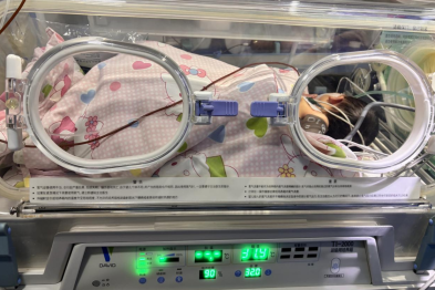 出生仅 4 天、体重 2.4 公斤！亚心专家微创技术为早产「紫娃娃」打通紧闭「心门」