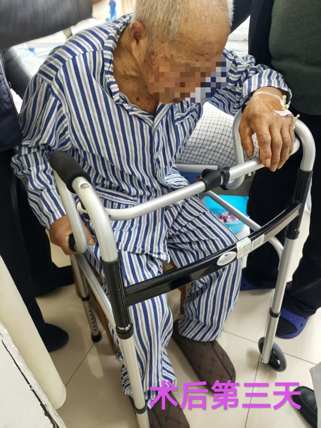 高龄不是禁区!89 岁河南老人开荒摔骨折,人工股骨头置换术后重获行走能力!