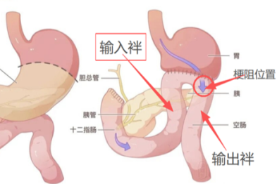 肿瘤患者腰疼不一定是骨转移，吃不下饭未必是绝境 合肥京东方医院多学科协作，破解两大疑难病例