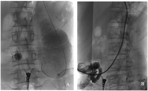 肿瘤患者腰疼不一定是骨转移，吃不下饭未必是绝境 合肥京东方医院多学科协作，破解两大疑难病例
