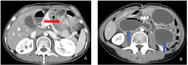 肿瘤患者腰疼不一定是骨转移，吃不下饭未必是绝境 合肥京东方医院多学科协作，破解两大疑难病例