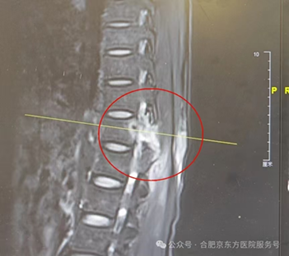 30 年修复万根脊柱，合肥京东方医院骨科刘艺明