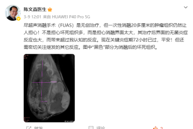 拒截肢！28 cm「巨型」腿部瘤，重庆海扶医院硬核保肢