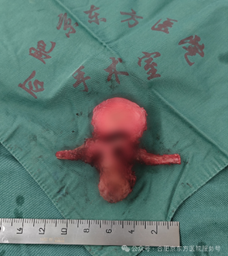 30 年修复万根脊柱，合肥京东方医院骨科刘艺明