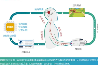 全球脑机接口迎来中国突破！健嘉康复深耕赛道，用科技点亮康复新希望