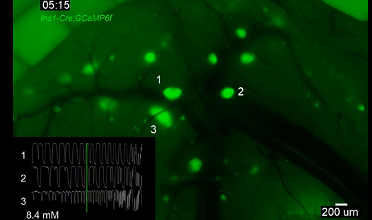 血糖高了，谁来「报信」？创新中心任会霞团队发现胰岛里的「对话」机制