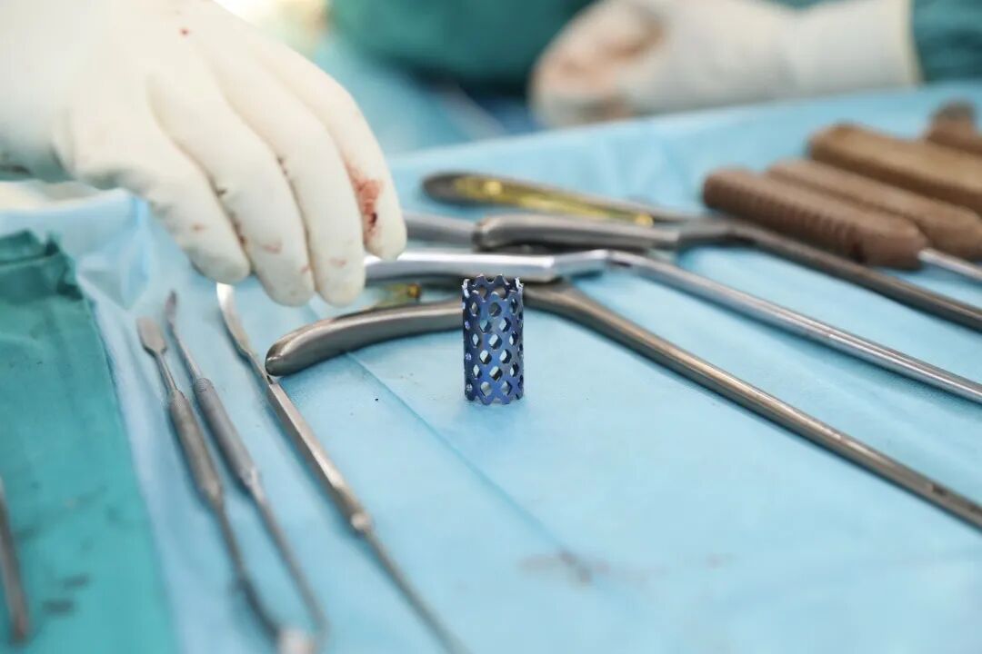 腰痛腿麻，是癌转移？专家一查：竟是比转移更罕见的「元凶」