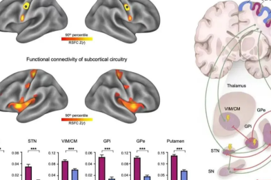 帕金森病研究入选中关村论坛重大科技成果！上海天佑医院成为该成果转化示范中心