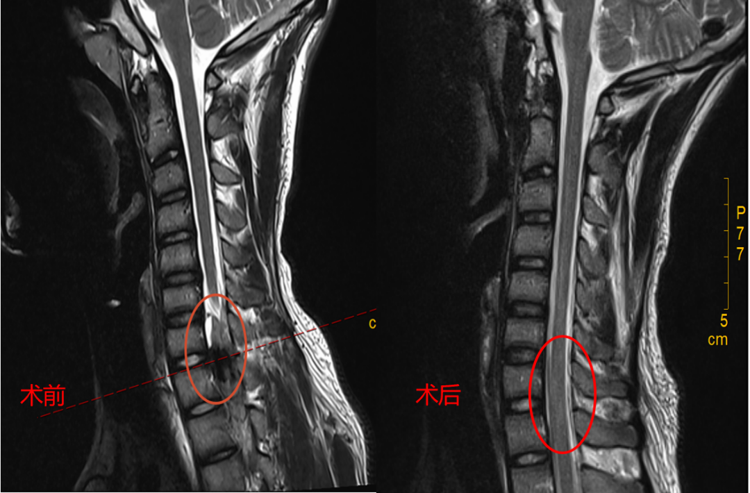 这个病，让高三学子 12 年寒窗苦读差点毁于一旦