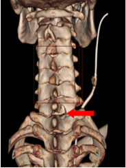这个病，让高三学子 12 年寒窗苦读差点毁于一旦
